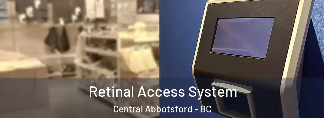  Retinal Access System Central Abbotsford - BC