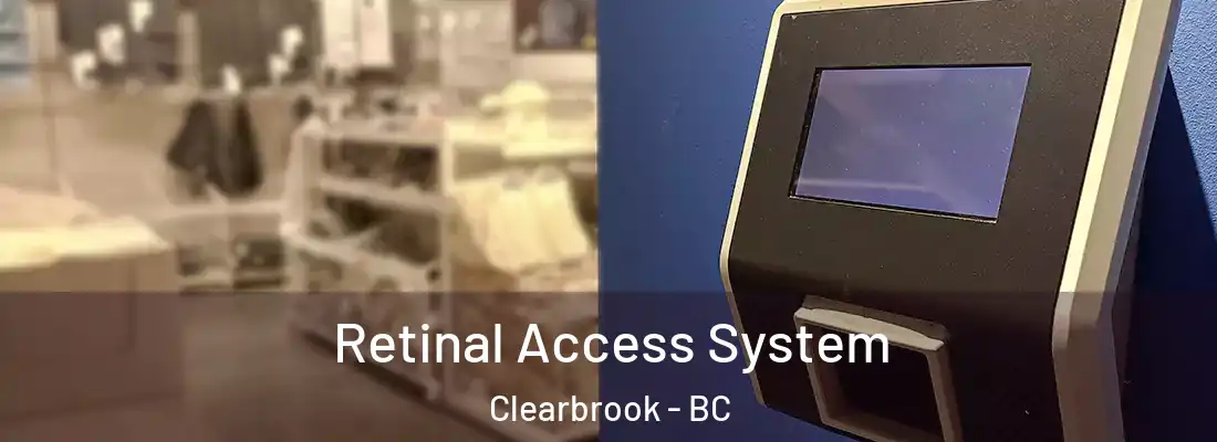  Retinal Access System Clearbrook - BC